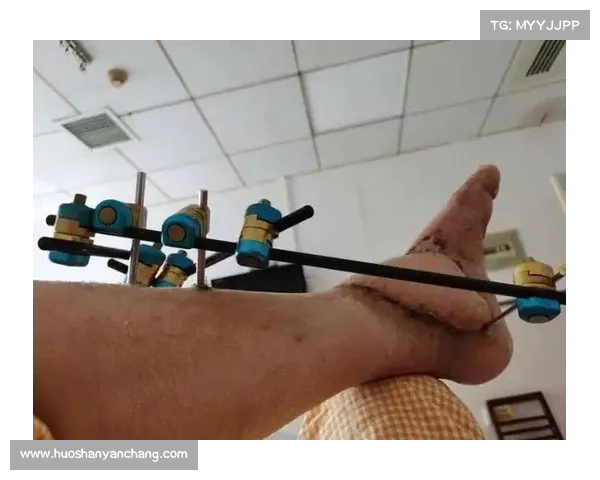 王祉惜决赛局医疗暂停揭秘 脚踝固定带技术创新全解析